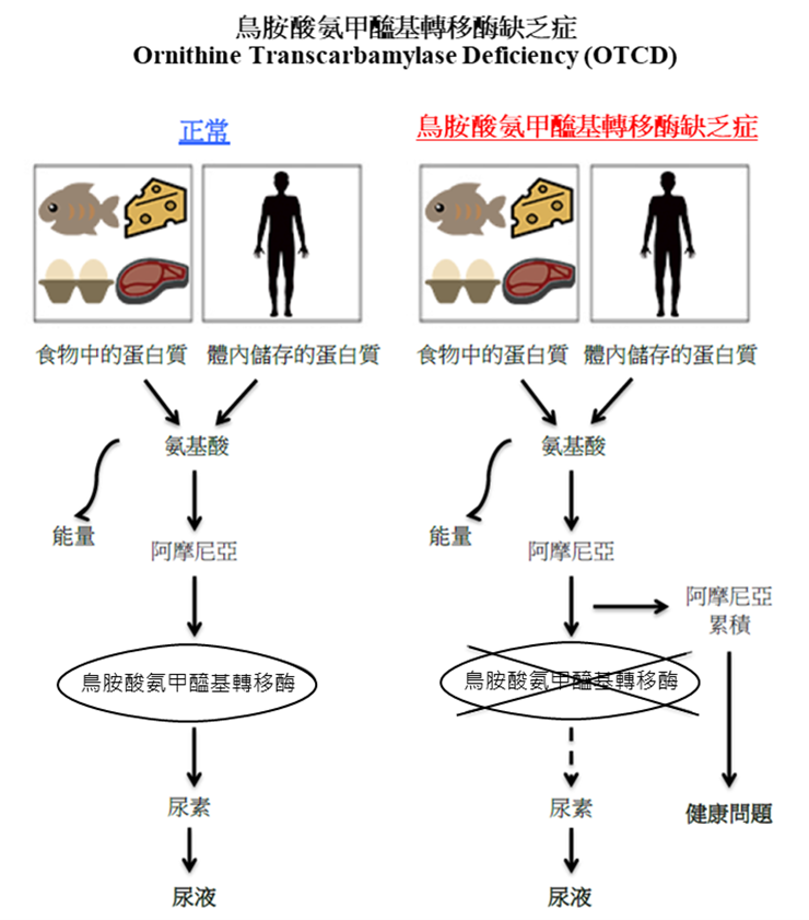 鳥胺酸氨甲醯基轉移酶缺乏症圖解